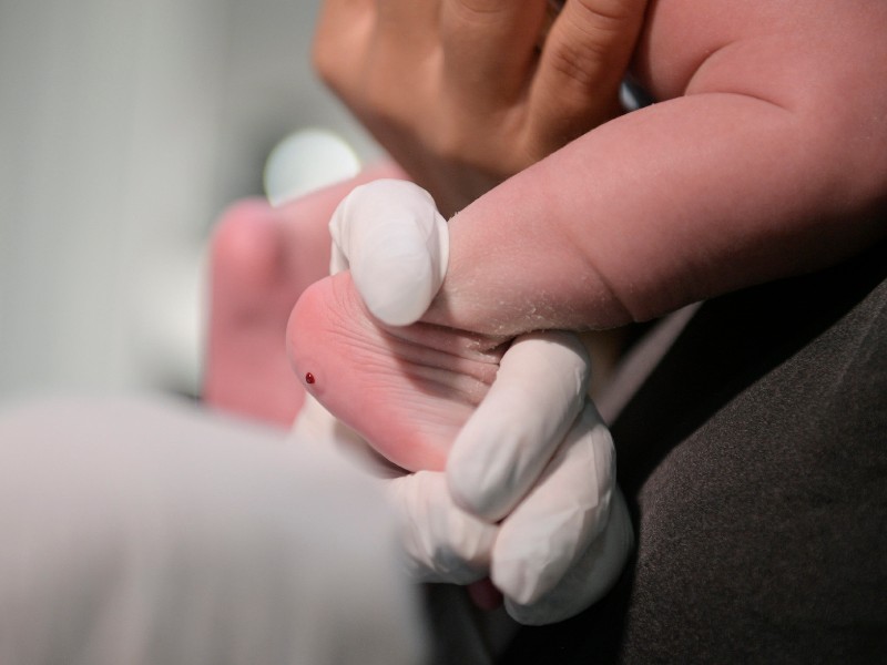 Mão de enfermeira com luva branca segura o pezinho de um bebê com uma gota de sangue no calcanhar para fazer o teste